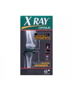 X Ray Tratamiento Para Osteoartritis